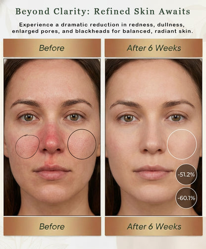 ( Red Light Therapy Mask) Anti-Acne & Anti-Aging Skincare