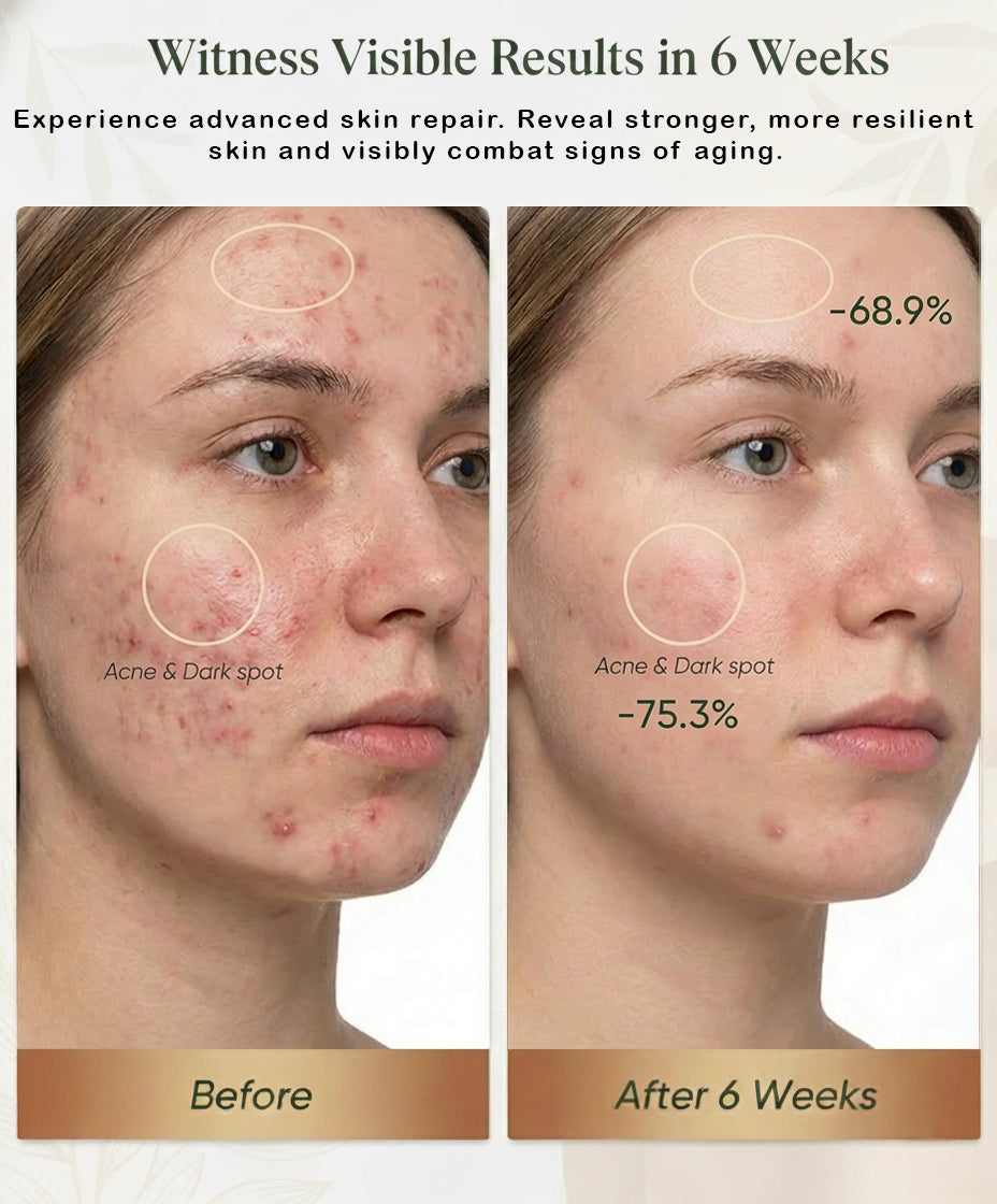 ( Red Light Therapy Mask) Anti-Acne & Anti-Aging Skincare