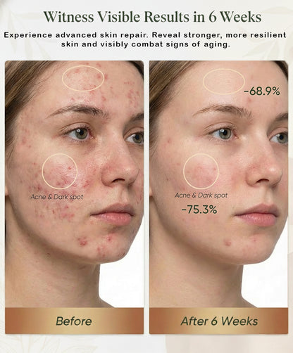 ( Red Light Therapy Mask) Anti-Acne & Anti-Aging Skincare